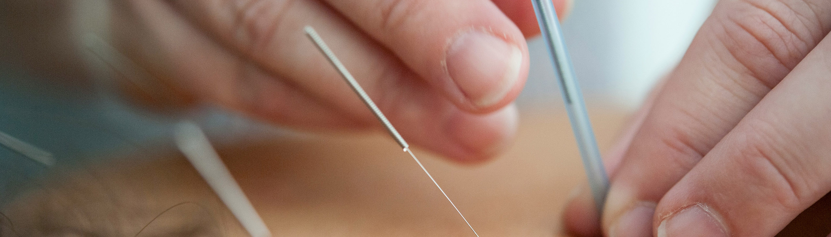 Traditional acupuncture points and calming therapy environment